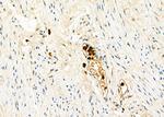 CD162 Antibody in Immunohistochemistry (Paraffin) (IHC (P))