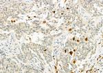 CD162 Antibody in Immunohistochemistry (Paraffin) (IHC (P))