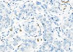 CD162 Antibody in Immunohistochemistry (Paraffin) (IHC (P))