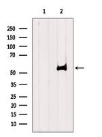 SLC22A5 Antibody in Western Blot (WB)