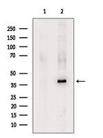 KIR2DL1 Antibody in Western Blot (WB)