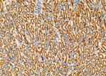 WFS1 Antibody in Immunohistochemistry (Paraffin) (IHC (P))