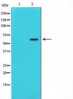 CYP11A1 Antibody in Western Blot (WB)