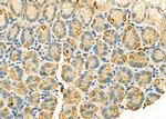 IGFBP5 Antibody in Immunohistochemistry (Paraffin) (IHC (P))