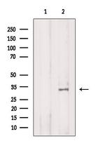 IGFBP5 Antibody in Western Blot (WB)