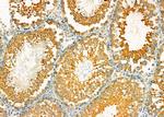 Uteroglobin Antibody in Immunohistochemistry (Paraffin) (IHC (P))