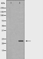 FXN Antibody in Western Blot (WB)