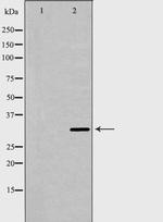 Cyclin D2 Antibody in Western Blot (WB)