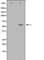 PSAP Antibody in Western Blot (WB)