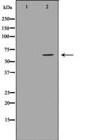 IL10RA Antibody in Western Blot (WB)