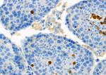 HCFC1 Antibody in Immunohistochemistry (Paraffin) (IHC (P))