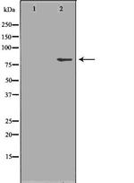 beta Galactosidase Antibody in Western Blot (WB)