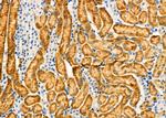 ANT Antibody in Immunohistochemistry (Paraffin) (IHC (P))