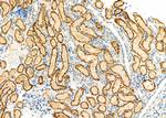 ANT Antibody in Immunohistochemistry (Paraffin) (IHC (P))