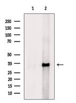 ANT Antibody in Western Blot (WB)