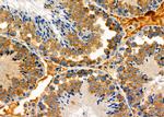 EPHX2 Antibody in Immunohistochemistry (Paraffin) (IHC (P))