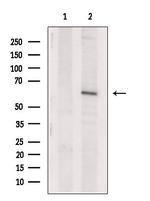 EPHX2 Antibody in Western Blot (WB)