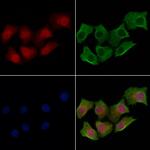 HOXA9 Antibody in Immunocytochemistry (ICC/IF)