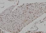 HOXA9 Antibody in Immunohistochemistry (Paraffin) (IHC (P))