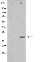 HOXA9 Antibody in Western Blot (WB)