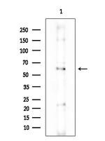 Uromodulin Antibody in Western Blot (WB)