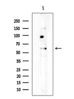 Uromodulin Antibody in Western Blot (WB)