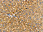 CD204 Antibody in Immunohistochemistry (Paraffin) (IHC (P))