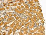 CD204 Antibody in Immunohistochemistry (Paraffin) (IHC (P))