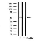 CD204 Antibody in Western Blot (WB)