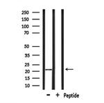 GPX4 Antibody in Western Blot (WB)