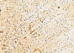 RAB27A Antibody in Immunohistochemistry (Paraffin) (IHC (P))