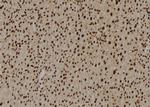 U2AF2 Antibody in Immunohistochemistry (Paraffin) (IHC (P))