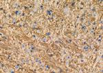 GluR6 Antibody in Immunohistochemistry (Paraffin) (IHC (P))