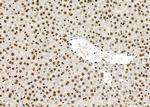 POLI Antibody in Immunohistochemistry (Paraffin) (IHC (P))