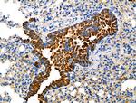 Glypican 3 Antibody in Immunohistochemistry (Paraffin) (IHC (P))