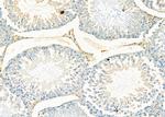 ODC1 Antibody in Immunohistochemistry (Paraffin) (IHC (P))