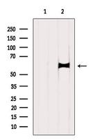 TCP1 Antibody in Western Blot (WB)