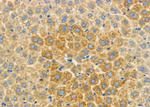 UBE2D1 Antibody in Immunohistochemistry (Paraffin) (IHC (P))