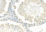 UBE2D1 Antibody in Immunohistochemistry (Paraffin) (IHC (P))