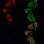 Tapasin Antibody in Immunocytochemistry (ICC/IF)