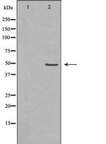 Tapasin Antibody in Western Blot (WB)