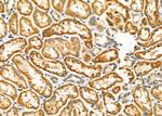 HSD17B2 Antibody in Immunohistochemistry (Paraffin) (IHC (P))