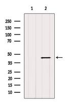 HSD17B2 Antibody in Western Blot (WB)