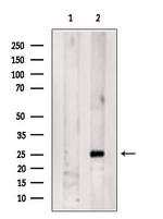 Serum Amyloid P Antibody in Western Blot (WB)