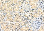 Cbl-b Antibody in Immunohistochemistry (Paraffin) (IHC (P))