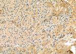 Cbl-b Antibody in Immunohistochemistry (Paraffin) (IHC (P))