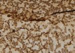 Cbl-b Antibody in Immunohistochemistry (Paraffin) (IHC (P))