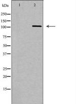 Cbl-b Antibody in Western Blot (WB)