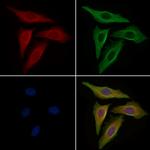 eIF5A Antibody in Immunocytochemistry (ICC/IF)