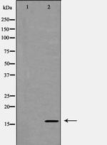 eIF5A Antibody in Western Blot (WB)